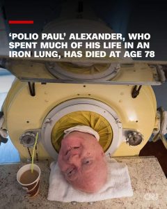 Polio Paul,’ The Man  Who Spent  70 Years Of His Life In An Iron Lung, Dies At 78